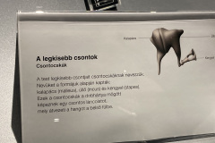Body-World-6